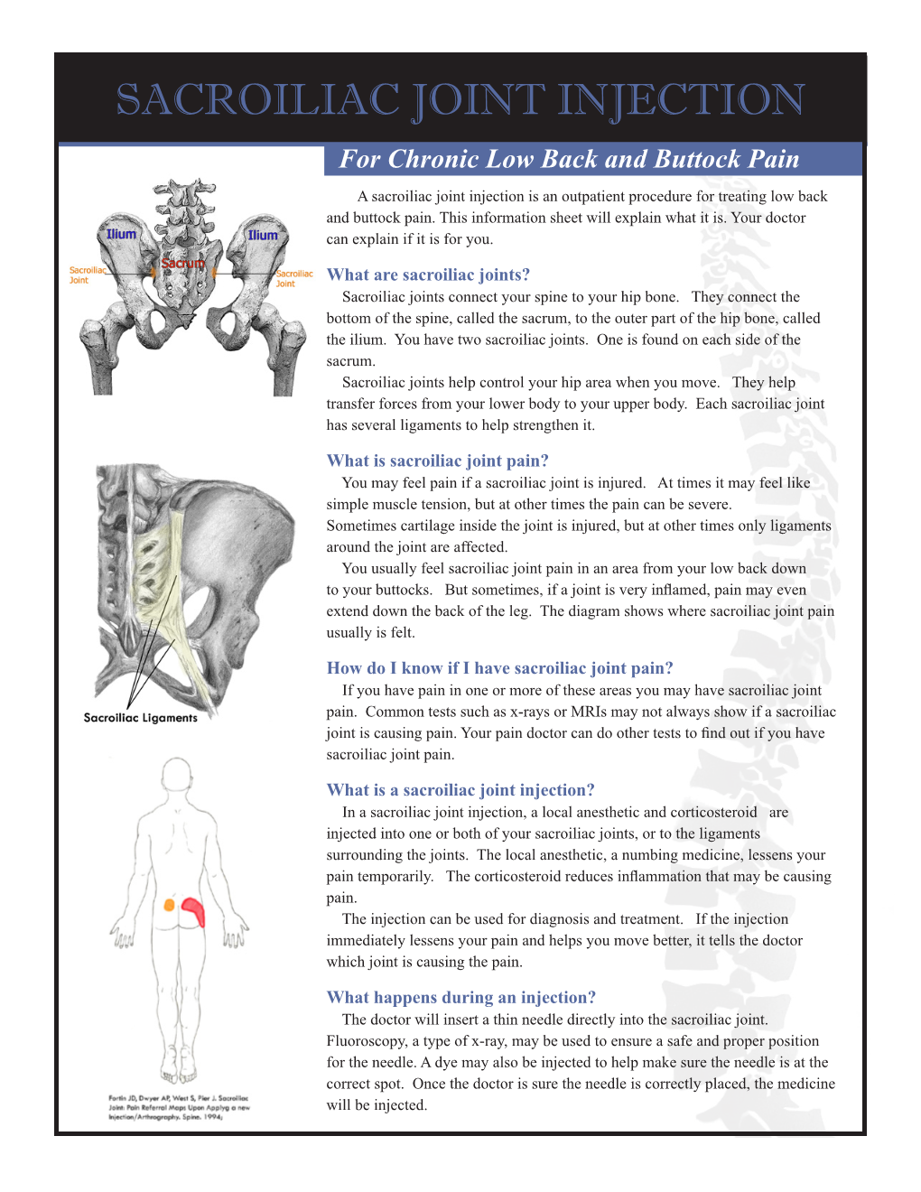 SACROILIAC JOINT INJECTION for Chronic Low Back and Buttock Pain a Sacroiliac Joint Injection Is an Outpatient Procedure for Treating Low Back and Buttock Pain