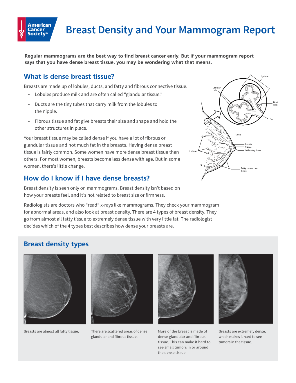 Breast Density and Your Mammogram Report