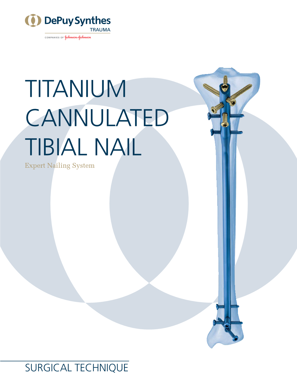 Titanium Cannulated Tibial Nail Expert Nailing System