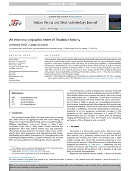 An Electrocardiographic Series of Flecainide Toxicity