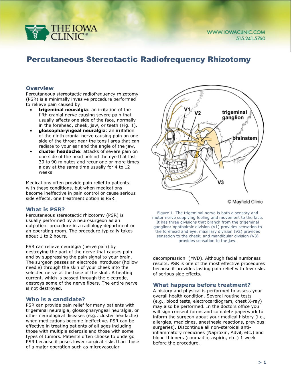 Percutaneous Stereotactic Radiofrequency Rhizotomy (PSR)