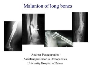 Malunion of Long Bones
