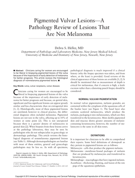 Pigmented Vulvar Lesionsva Pathology Review of Lesions That Are Not Melanoma