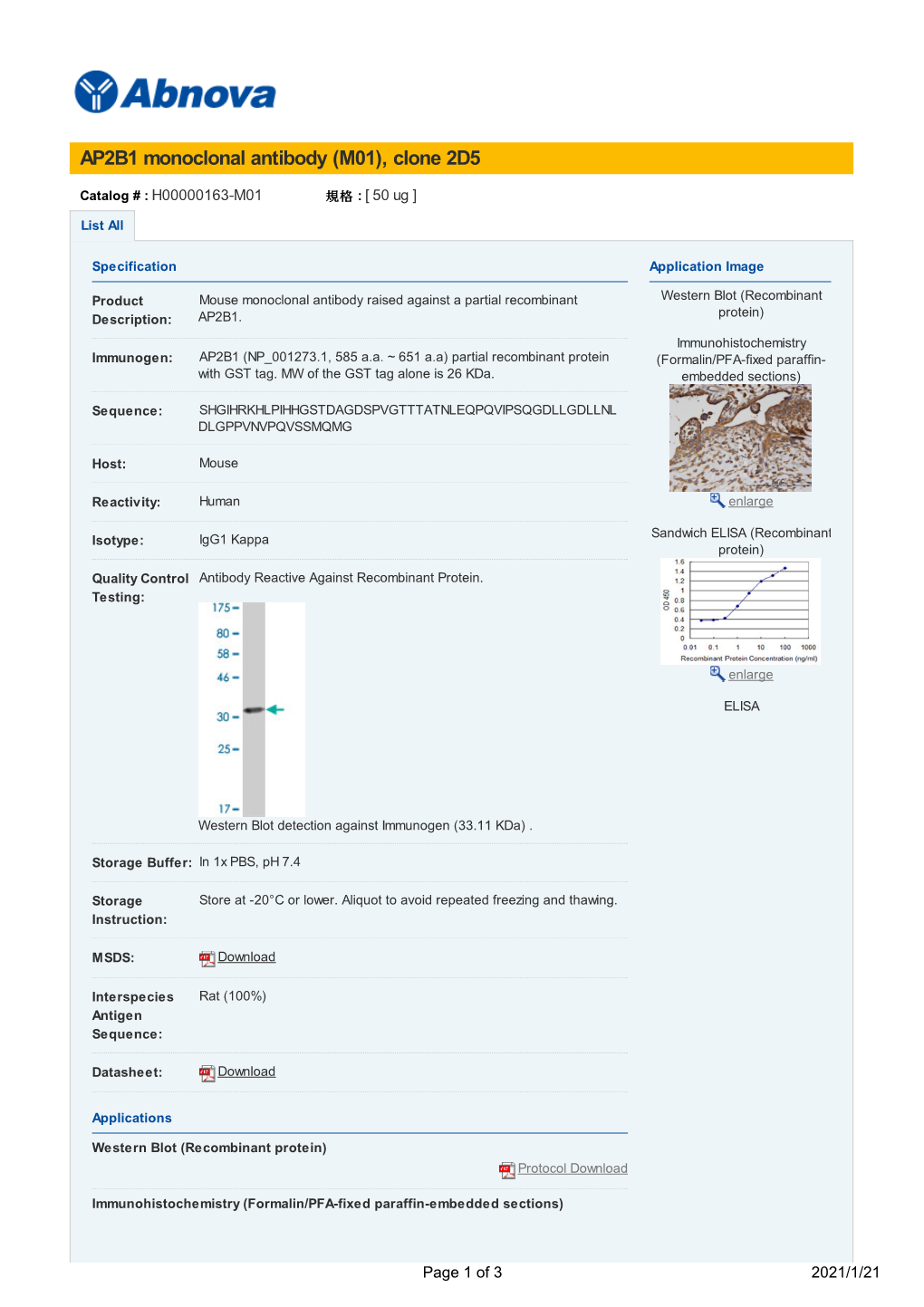 AP2B1 Monoclonal Antibody (M01), Clone 2D5