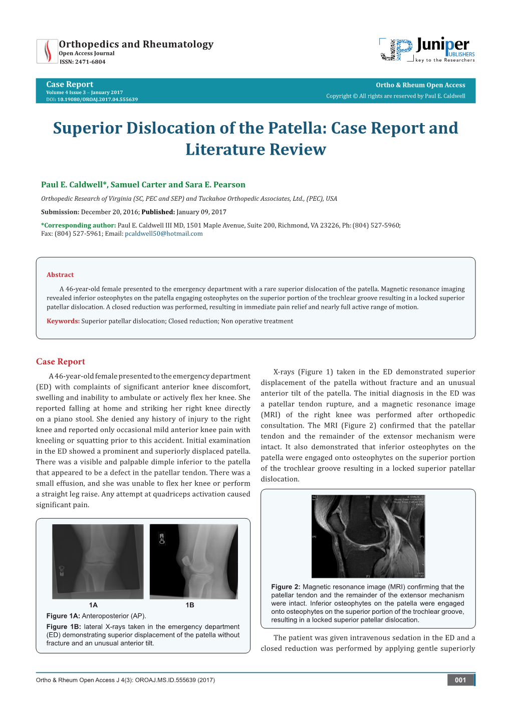 Superior Dislocation of the Patella: Case Report and Literature Review