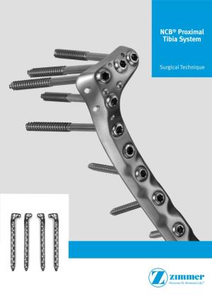 NCB® Proximal Tibia System Surgical Technique