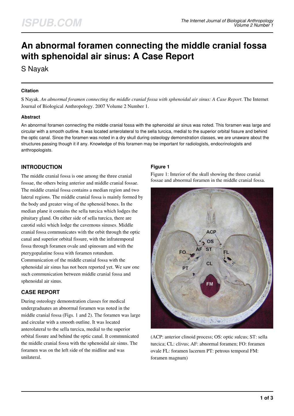 An Abnormal Foramen Connecting The Middle Cranial Fossa With Sphenoidal Air Sinus A Case Report 5875