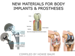 New Materials for Body Implants & Prostheses