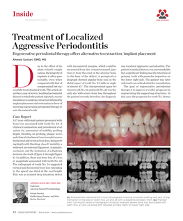 Treatment of Localized Aggressive Periodontitis Regenerative Periodontal Therapy Offers Alternative to Extraction/Implant Placement Ahmad Soolari, DMD, MS