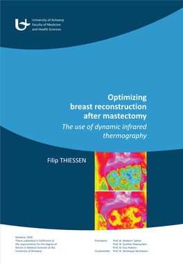 Optimizing Breast Reconstruction After Mastectomy University of Antwerp Faculty of Medicine and Health Sciences