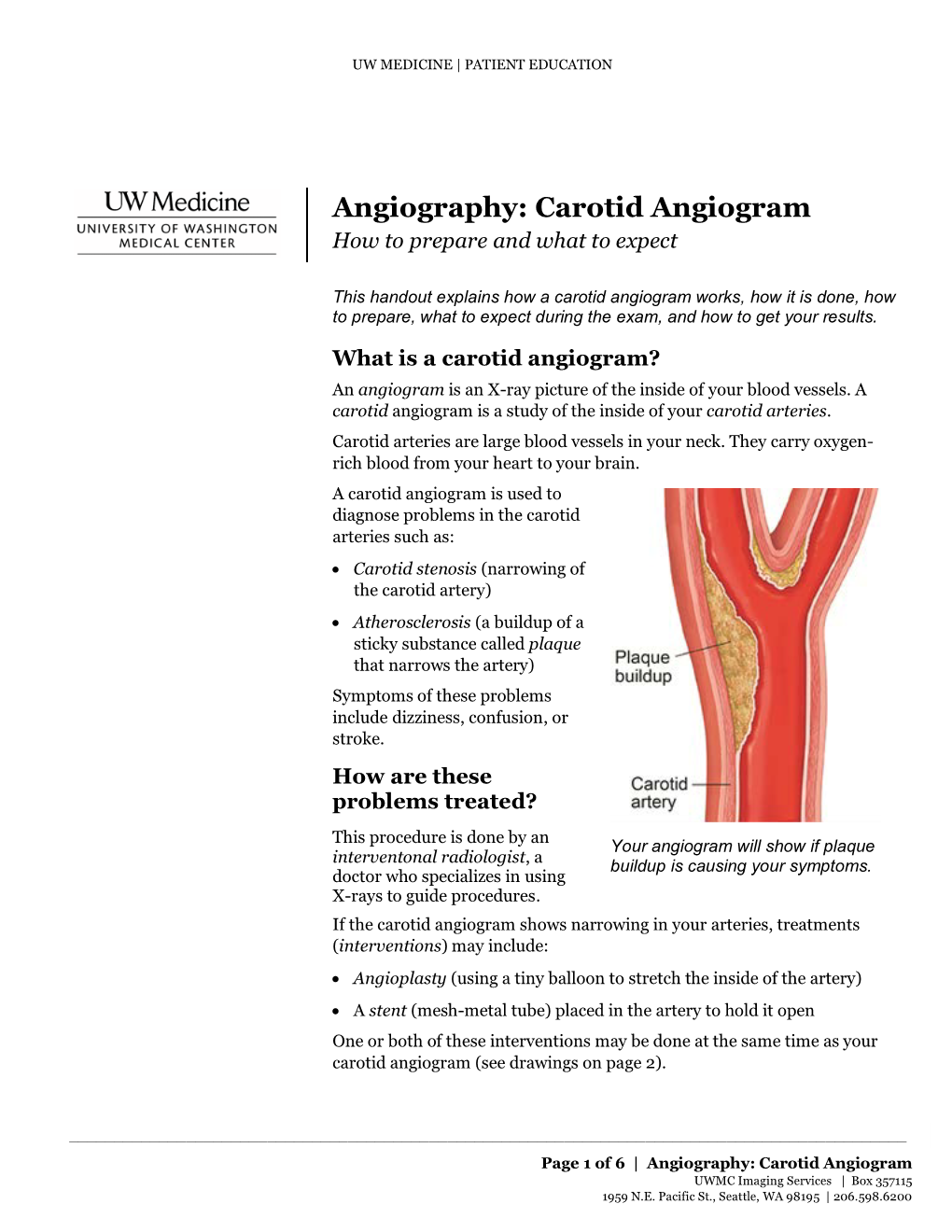 Carotid Angiogram | How to Prepare and What to Expect |