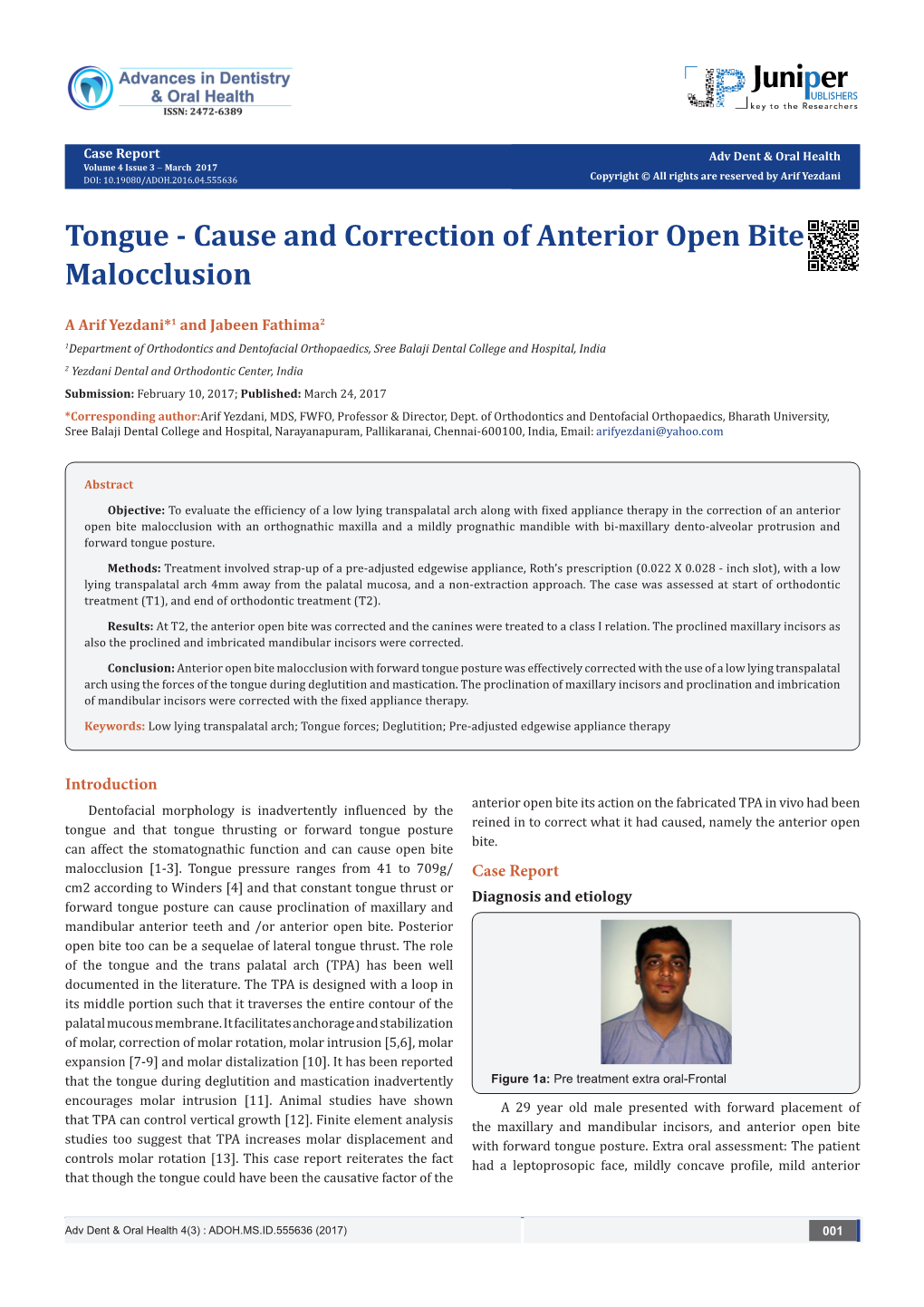 Tongue - Cause and Correction of Anterior Open Bite Malocclusion