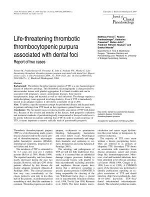 Life-Threatening Thrombotic Thrombocytopenic Purpura Associated with Dental Foci