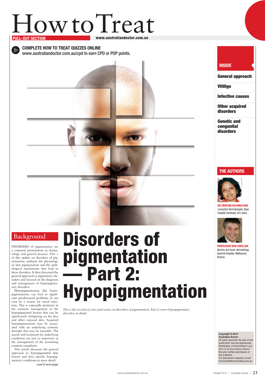 Disorders of Pigmentation — Part 2: Hypopigmentation