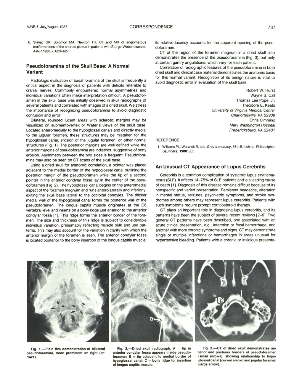 Pseudoforamina of the Skull Base: a Normal Variant