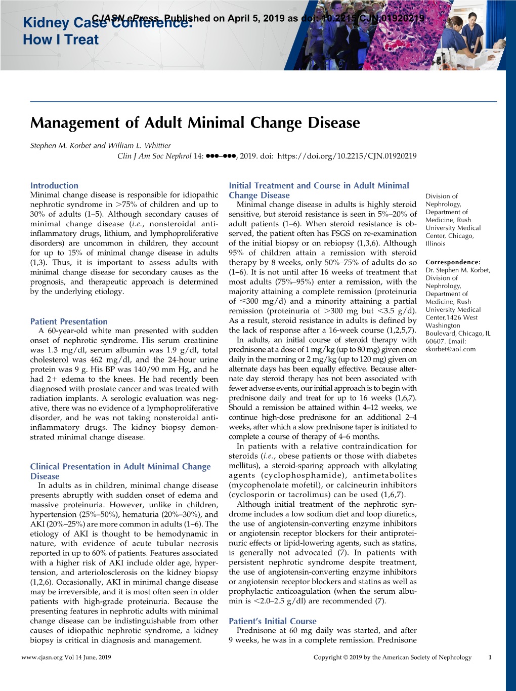 Management of Adult Minimal Change Disease