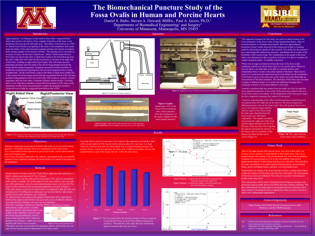 The Biomechanical Puncture Study of the Fossa Ovalis in Human and Porcine Hearts Daniel S