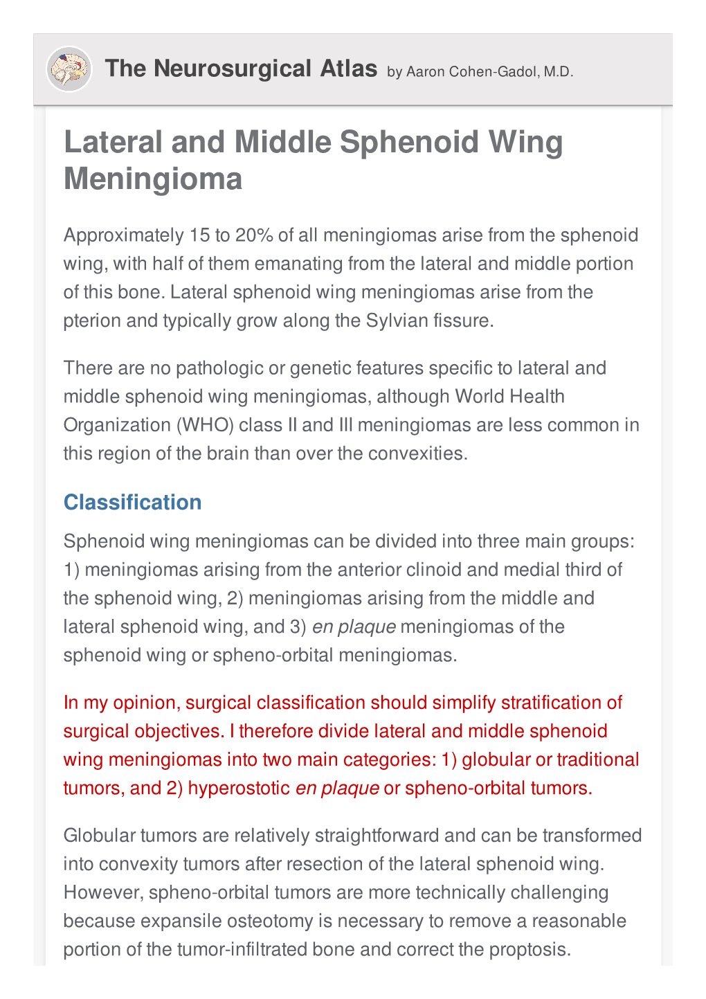 Lateral and Middle Sphenoid Wing Meningioma