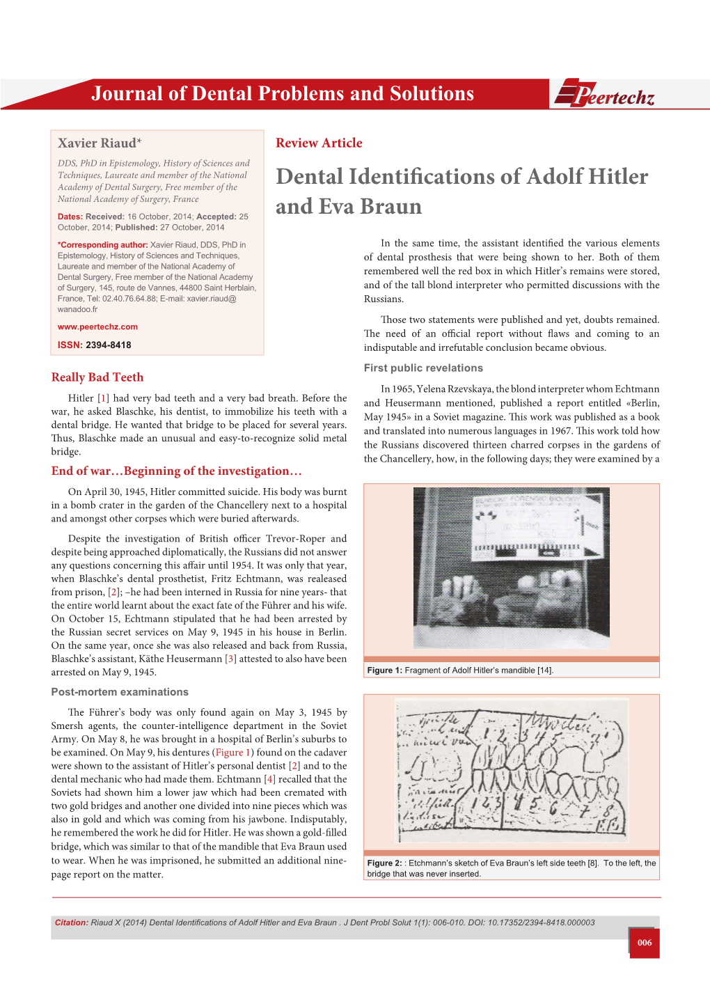 Dental Identifications of Adolf Hitler and Eva Braun