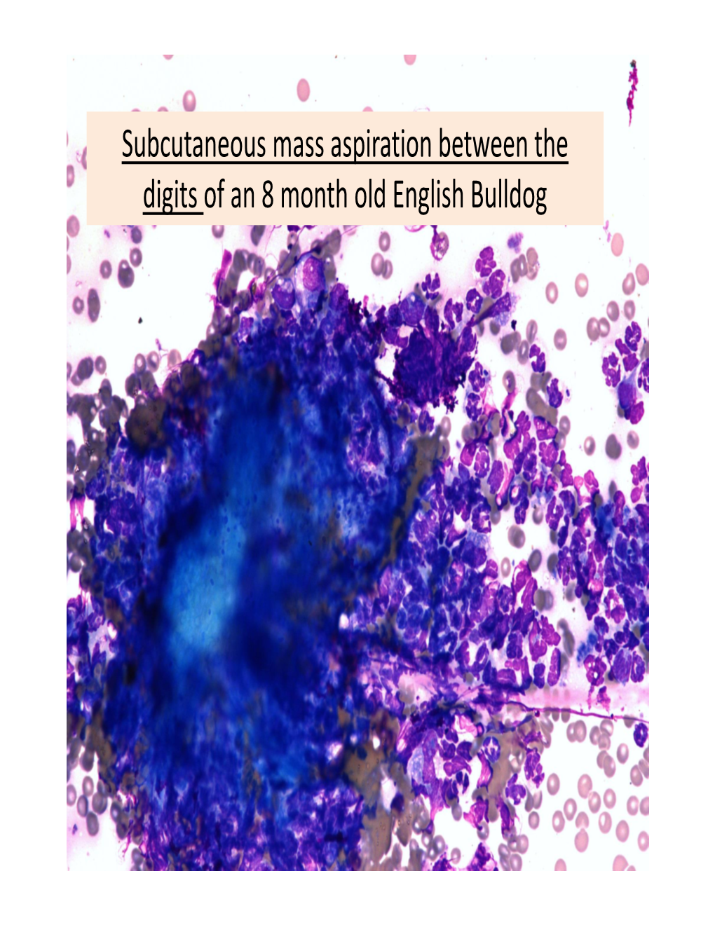 Subcutaneous Mass Aspiration Between the Digits of an 8 Month Old English Bulldog Marked Inflammation: Neutrophils & Macrophages