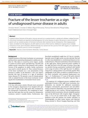 Fracture of the Lesser Trochanter As a Sign of Undiagnosed Tumor Disease in Adults Christian Herren*, Christian D