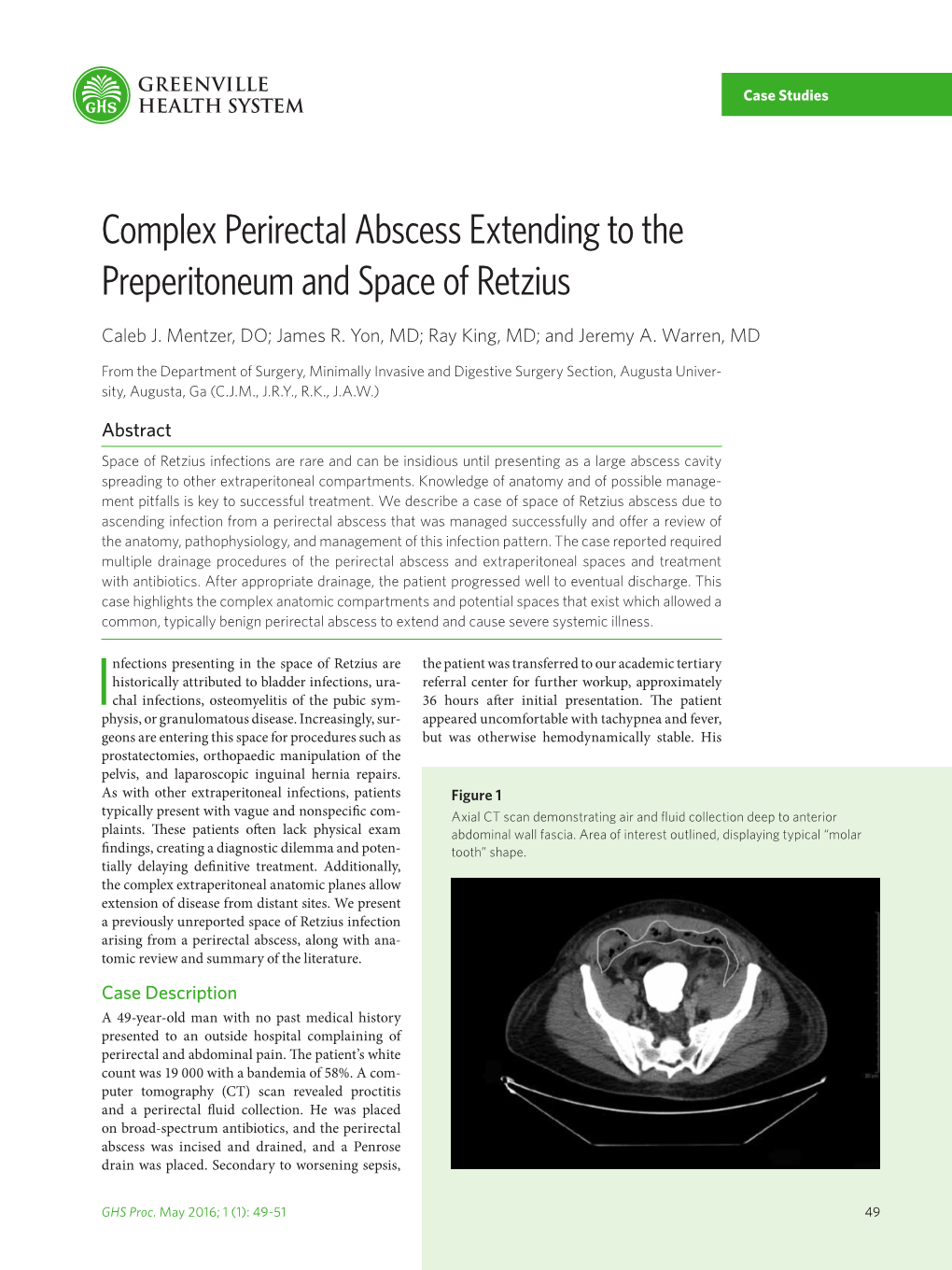 Complex Perirectal Abscess Extending To The Preperitoneum And Space Of