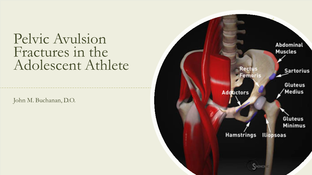 Pelvic Avulsion Fractures in the Adolescent Athlete