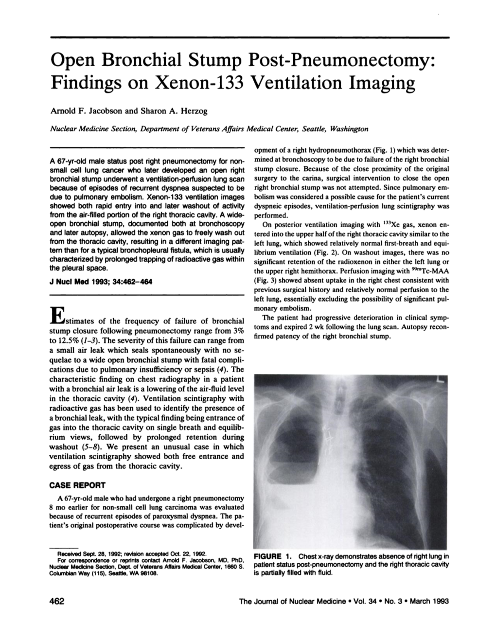 Open Bronchial Stump Post-Pneumonectomy: Findings on Xenon-133 Ventilation Imaging