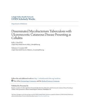 Disseminated Mycobacterium Tuberculosis with Ulceronecrotic Cutaneous Disease Presenting As Cellulitis Kelly L
