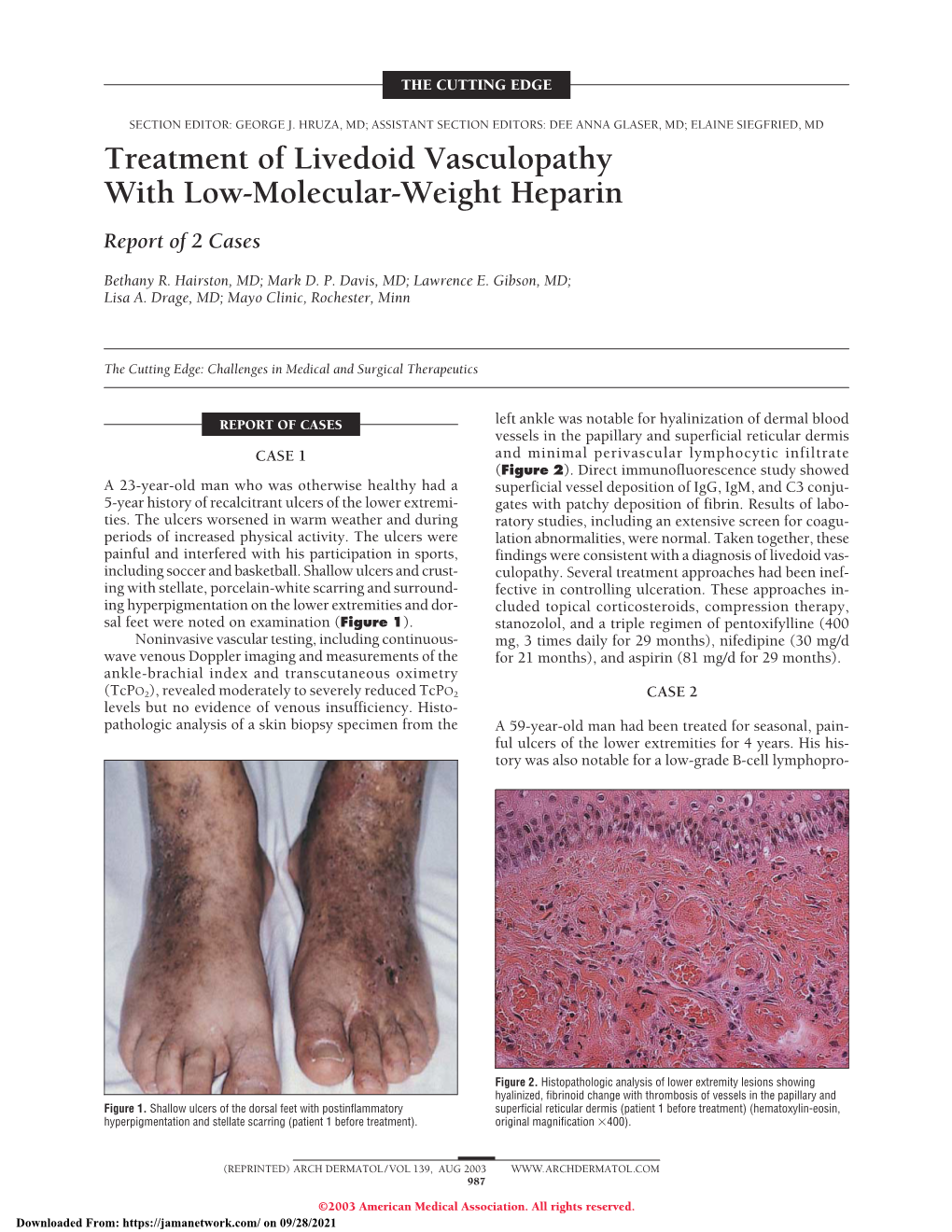 Treatment of Livedoid Vasculopathy with Low-Molecular-Weight Heparin Report of 2 Cases