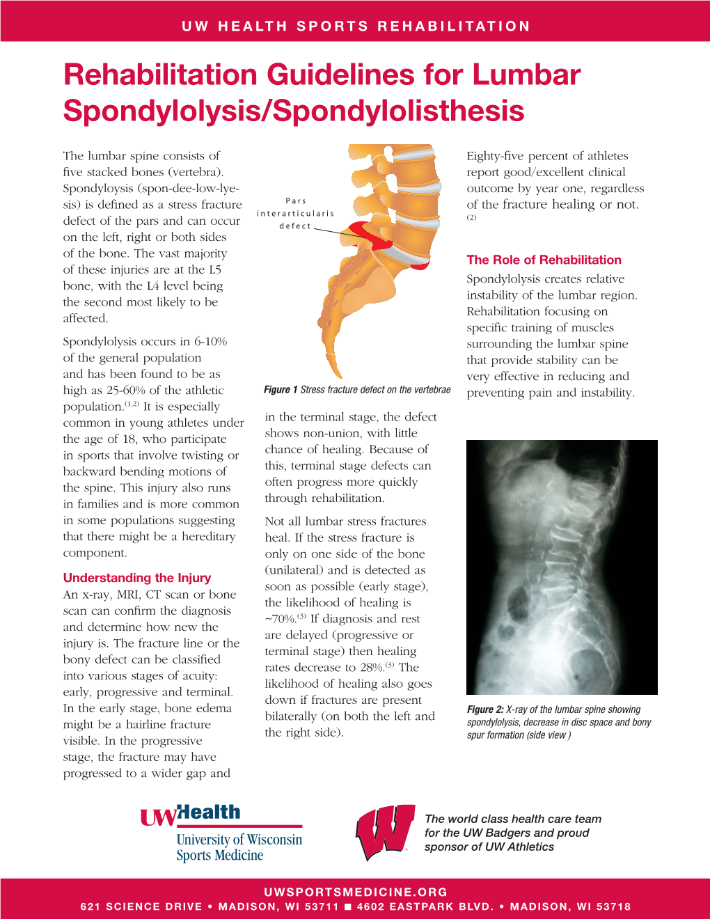 summary of guidelines for the treatment of lumbar spondylolisthesis