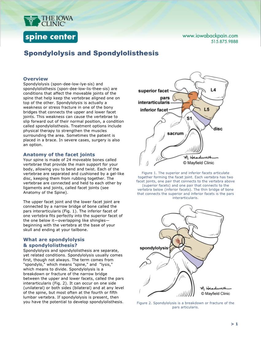 Spondylolysis and Spondylolisthesis