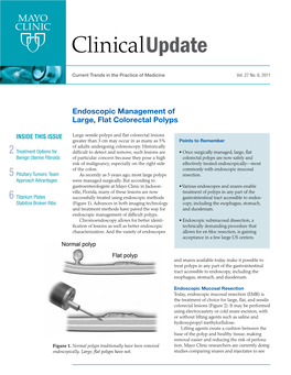 Endoscopic Management of Large, Flat Colorectal Polyps