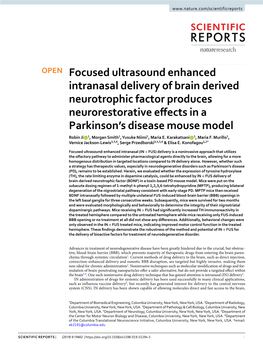 Focused Ultrasound Enhanced Intranasal Delivery of Brain Derived
