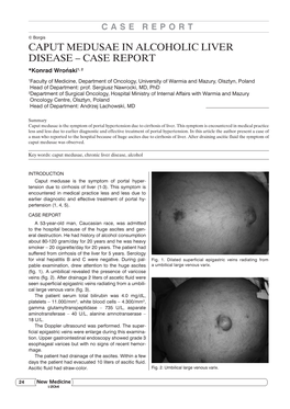 Caput Medusae in Alcoholic Liver Disease