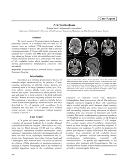 Neurosarcoidosis Case Report