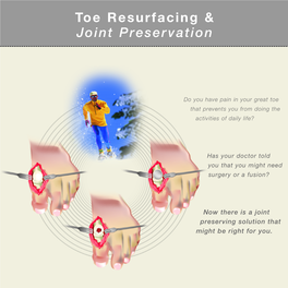 Toe Resurfacing & Joint Preservation