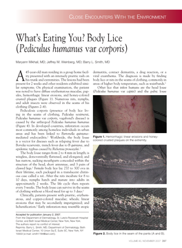Body Lice (Pediculus Humanus Var Corporis)