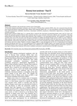 Ramsay Hunt Syndrome - Type II
