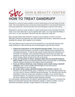 How to Treat Dandruff