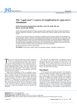 A Source of Complication in Vagus Nerve Stimulation