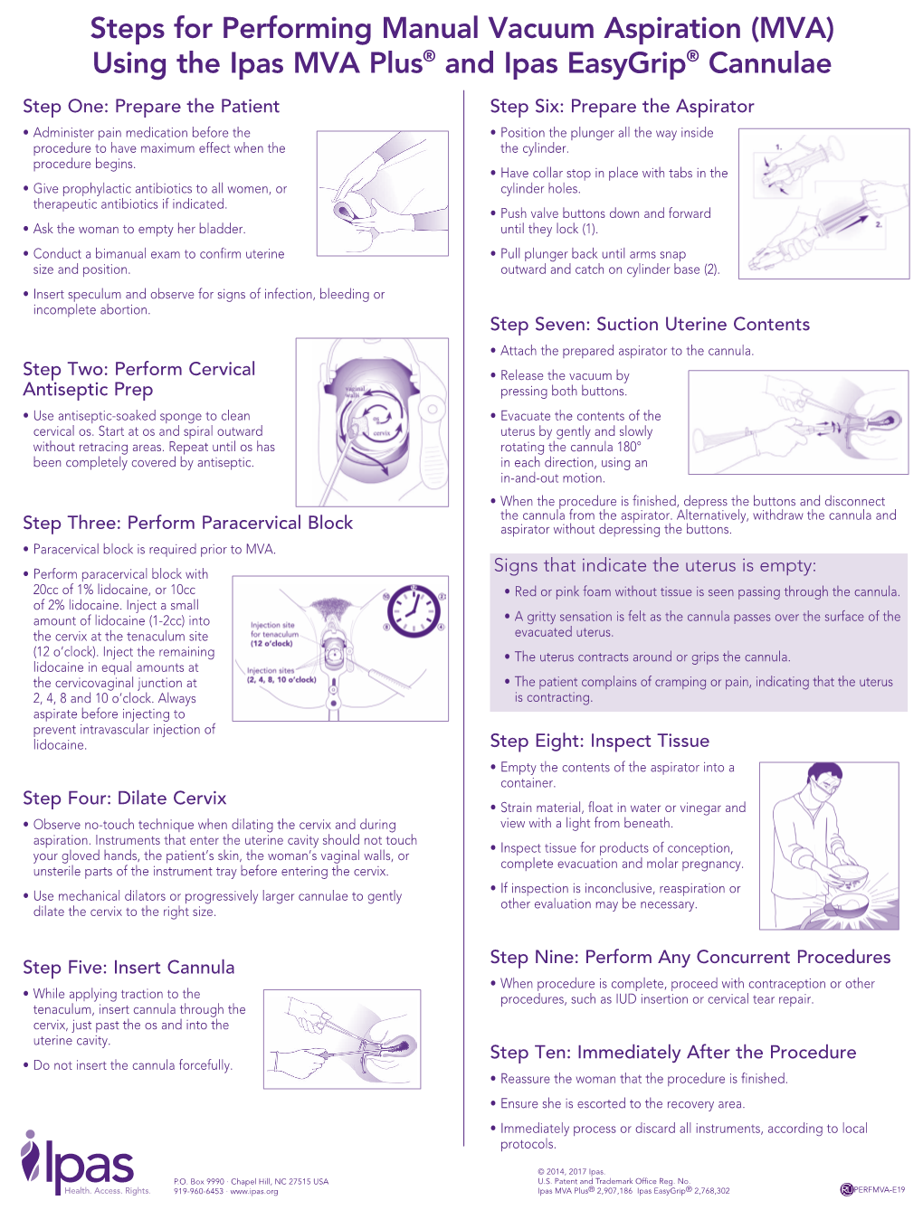 Steps for Performing Manual Vacuum Aspiration (MVA) Using the Ipas MVA Plus® and Ipas Easygrip® Cannulae