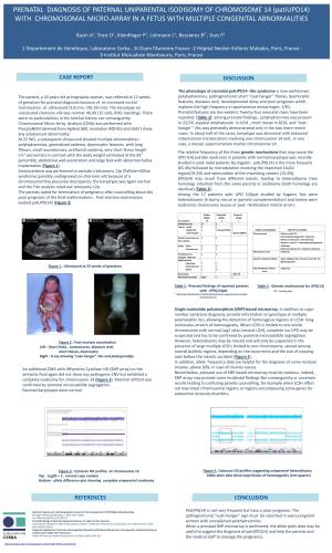 PRENATAL DIAGNOSIS of PATERNAL UNIPARENTAL ISODISOMY of CHROMOSOME 14 (Patiupd14) with CHROMOSOMAL MICRO-ARRAY in a FETUS with MULTIPLE CONGENITAL ABNORMALITIES