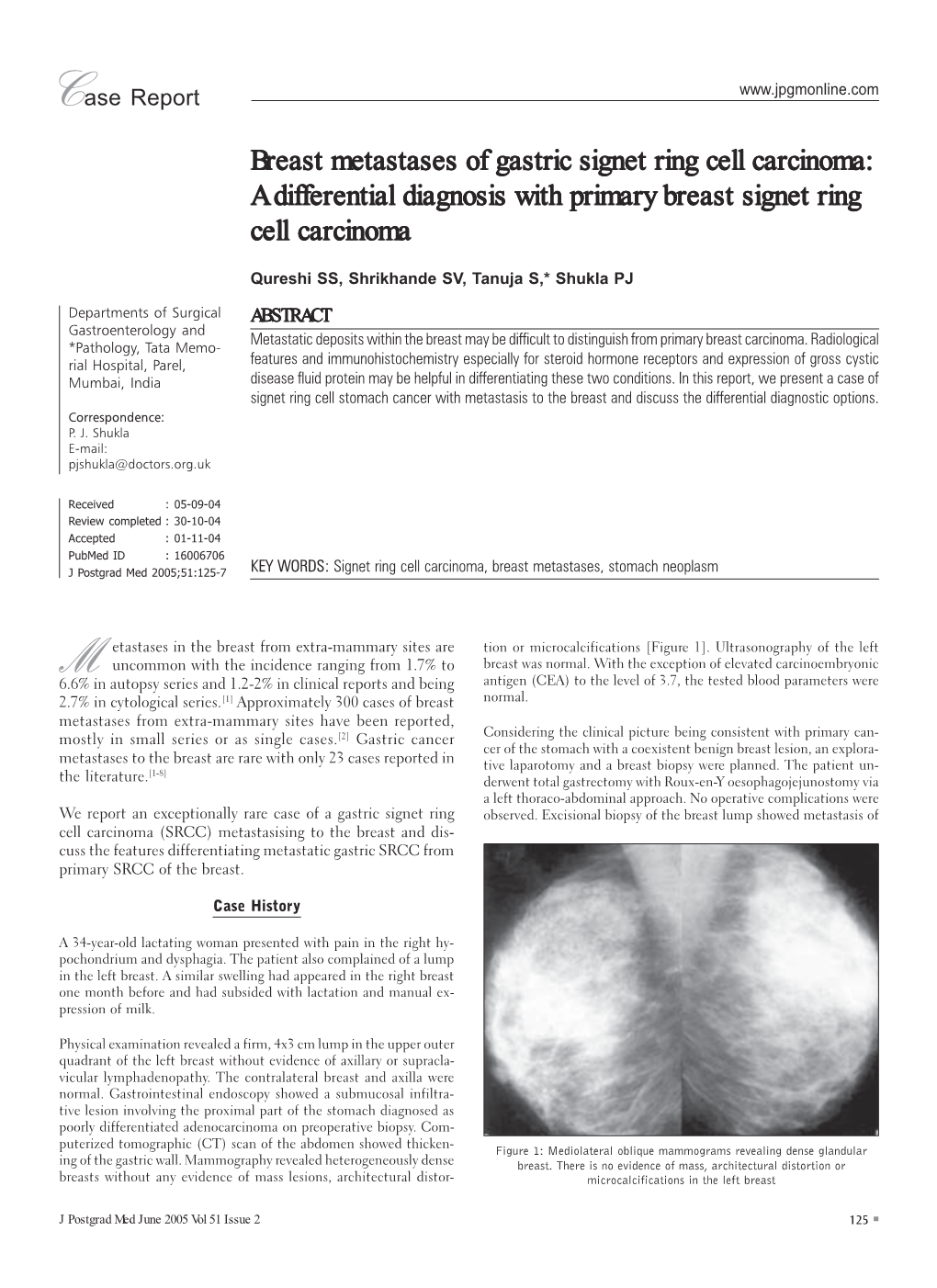 A Differential Diagnosis with Primary Breast Signet Ring Cell Carcinoma