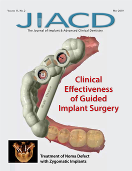 Clinical Effectiveness of Guided Implant Surgery
