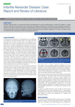 Infantile Alexander Disease: Case Report and Review of Literature Dentistry Section