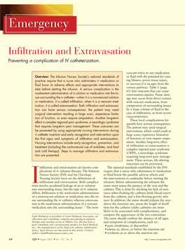 Infiltration and Extravasation Preventing a Complication of IV Catheterization