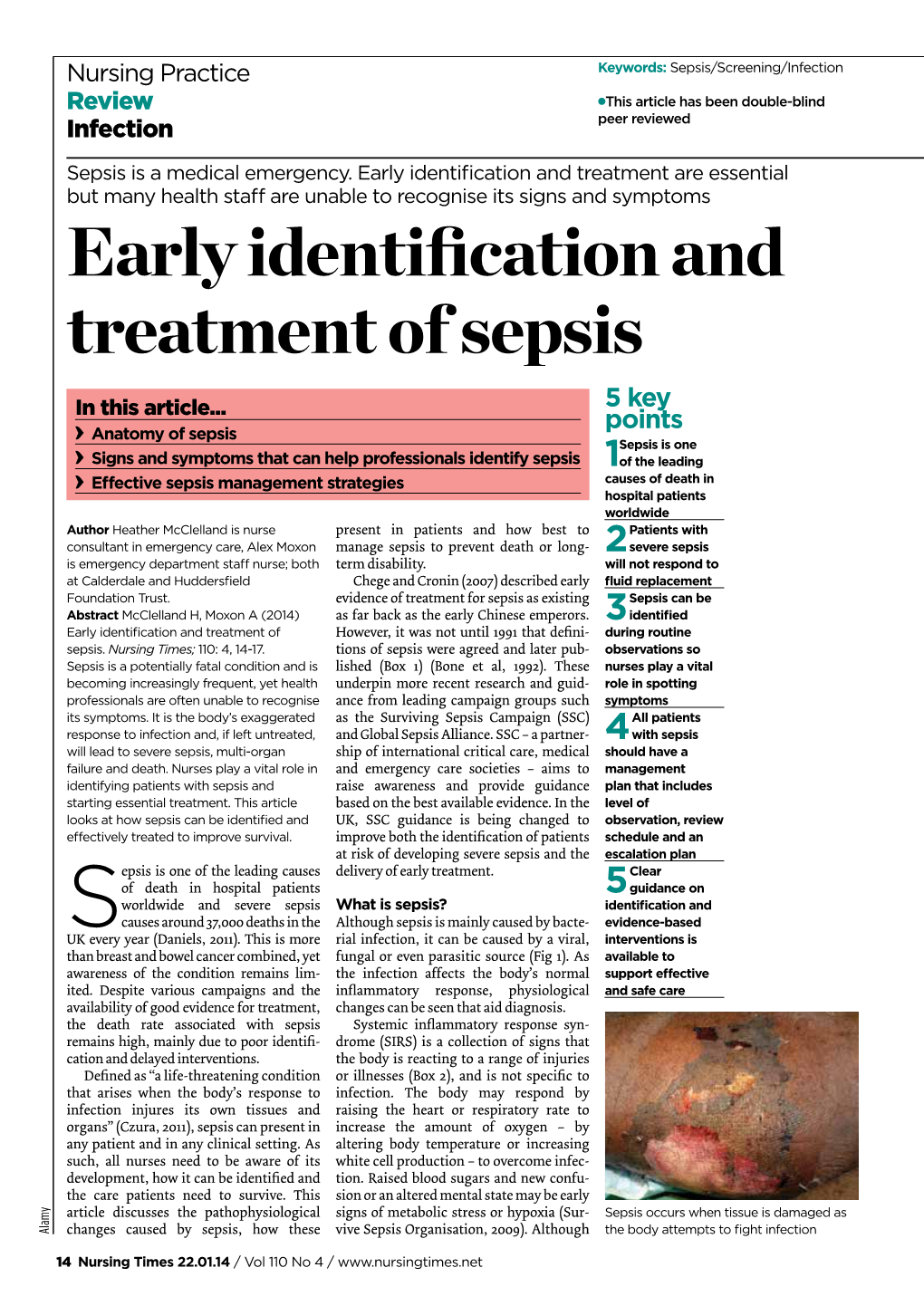 Early Identification and Treatment of Sepsis 5 Key in This Article