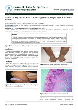 Acanthosis Nigricans in Areas of Resolving Psoriatic Plaques After