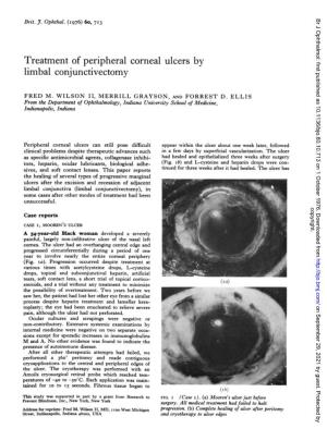 Treatment of Peripheral Corneal Ulcers by Limbal Conjunctivectomy